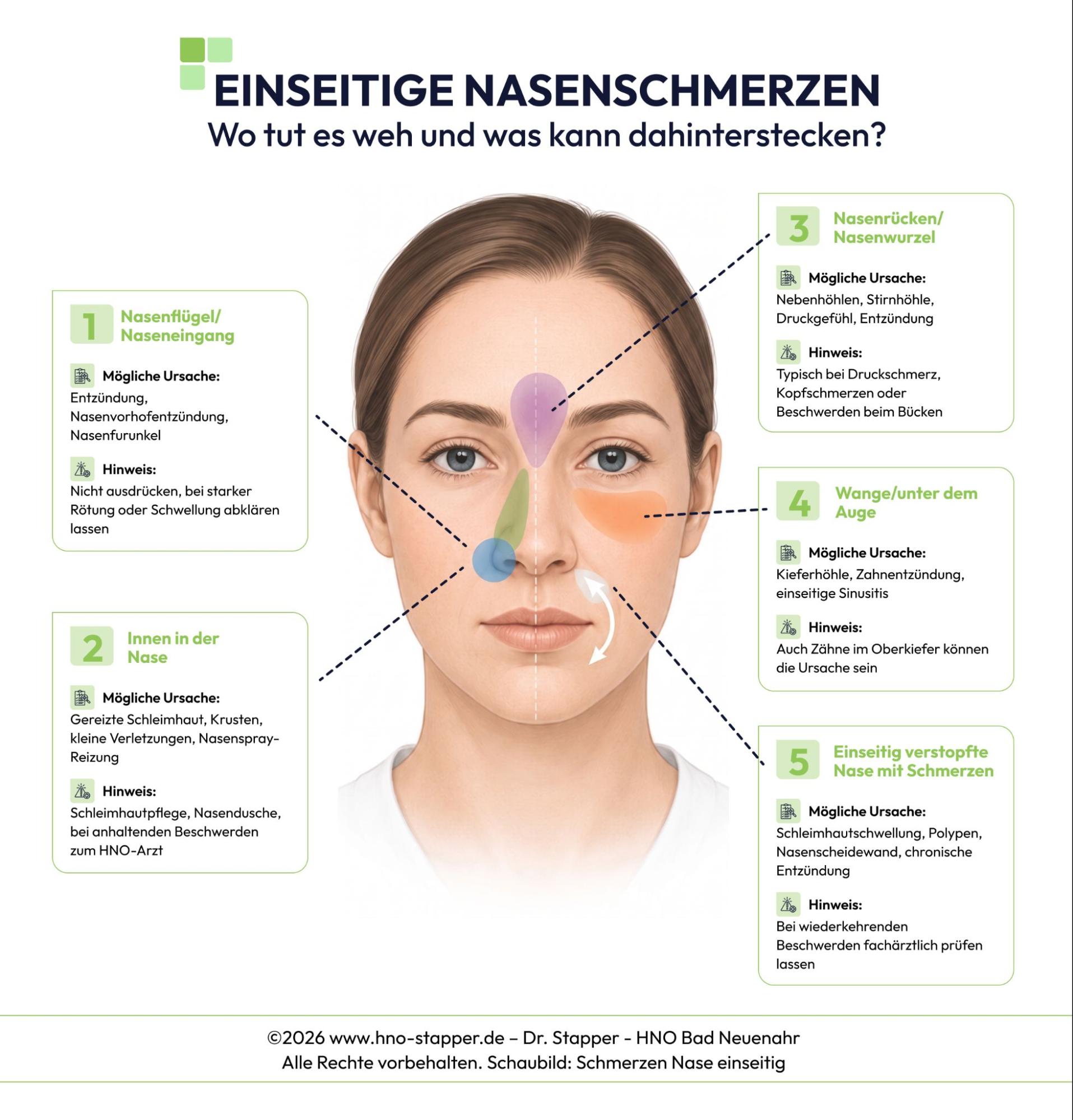 Infografik zu einseitigen Nasenschmerzen mit typischen Schmerzorten und möglichen Ursachen wie Sinusitis, Nasenfurunkel oder Schleimhautreizung